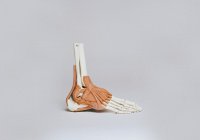 Чувствительные протезы ног разработаны в Швейцарии