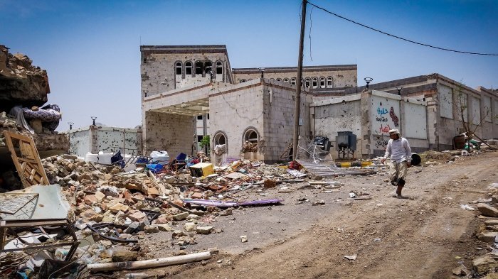Повальный голод в Йемене: могут ли международные акции спасти людей? 