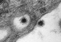 Научный центр «Вектор» впервые опубликовал фото дельта-штамма коронавируса