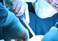 Пересадка волос в исламе: в каких случаях разрешена?