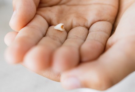 К чему снится выпадение зубов в исламе?